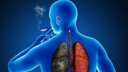Chile no da demasiada importancia al cáncer de pulmón